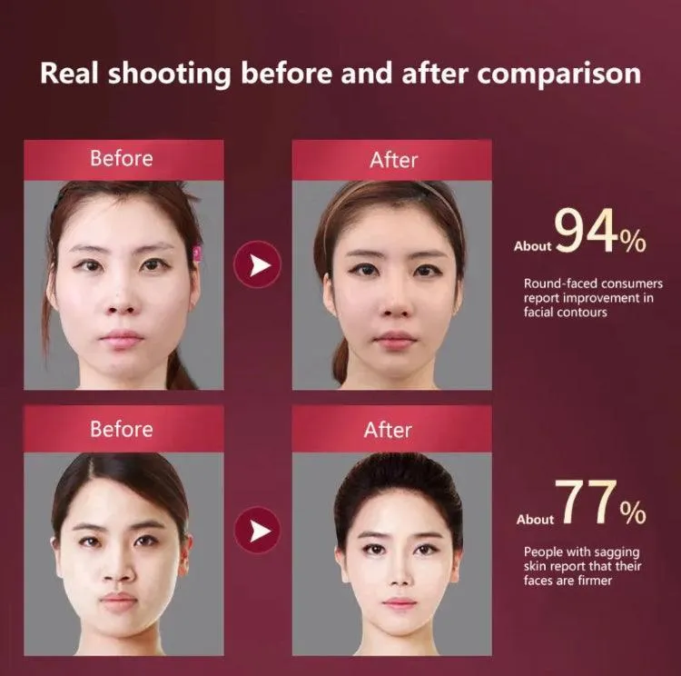 LED Photon Therapy Facial Slimming Massager Facial Lifting Device